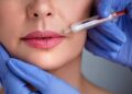 First-time lip fillers in the UK questions to ask before you book