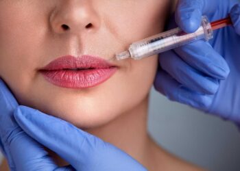 First-time lip fillers in the UK questions to ask before you book