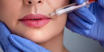 First-time lip fillers in the UK questions to ask before you book