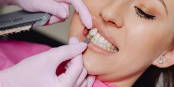 Enhancing Your Smile with Composite Veneers Dubai and Digital Dentistry